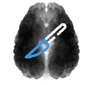 Cirurgia cerebral